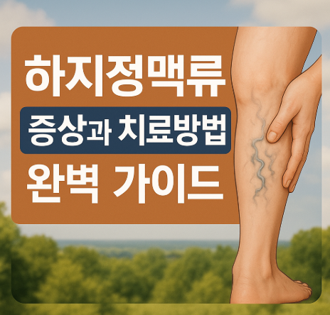 하지정맥류 증상과 치료방법 완벽 가이드 | 통증 원인부터 예방까지 2025 1 하지정맥류