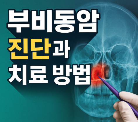 부비동암 초기증상 7가지 | 원인과 치료법 완벽 정리 2025 5 부비동암 진단과 치료 방법
