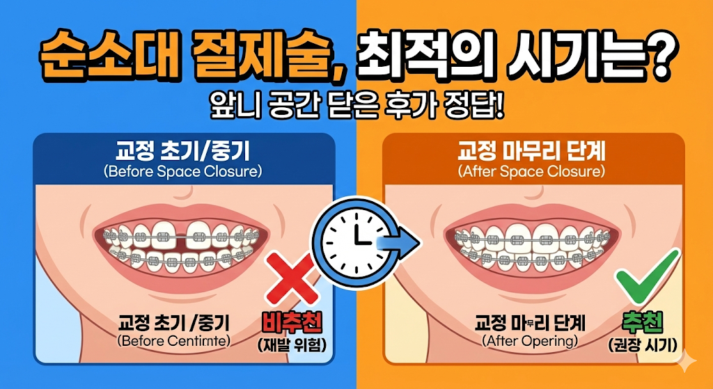 순소대 절제술 시기, 언제 하는 것이 가장 좋을까?